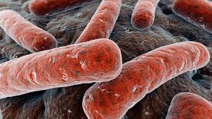 Tuberkulosis