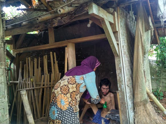 Asmir Belasan Tahun Lumpuh, Andalkan Obat Warung