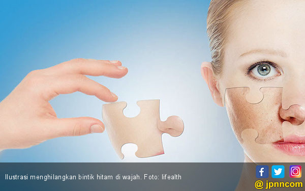 Hilangkan Bintik Hitam pada Wajah dengan Resep Alami