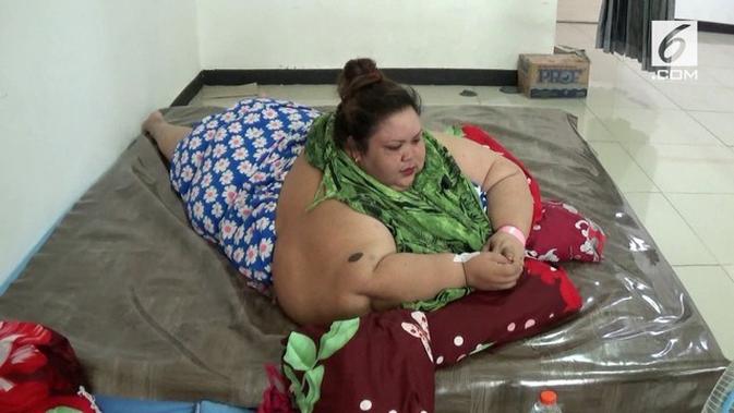 Lakukan Ini Kalau Tidak Mau Obesitas