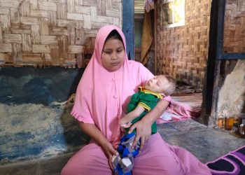 Derita Penyakit Langka, Balita di Lebak Ini Kondisinya Memprihatinkan