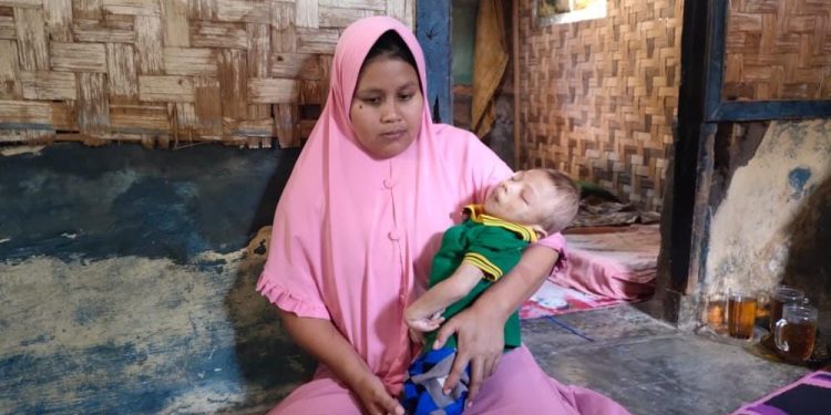 Derita Penyakit Langka, Balita di Lebak Ini Kondisinya Memprihatinkan