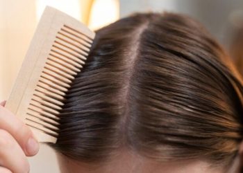 Kenali 7 Penyebab Rambut Rontok Agar Tidak Mengalami Kebotakan