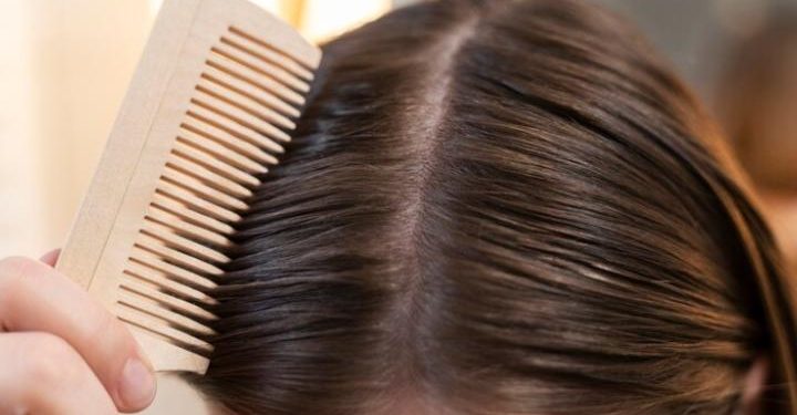Kenali 7 Penyebab Rambut Rontok Agar Tidak Mengalami Kebotakan