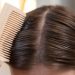 Kenali 7 Penyebab Rambut Rontok Agar Tidak Mengalami Kebotakan