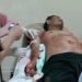 Diterkam Buaya, Warga Pandeglang Alami Patah Tulang dan Luka Robek Sekujur Tubuh