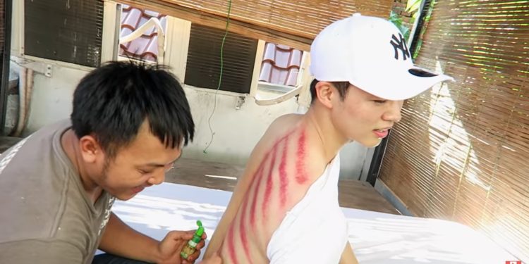 Youtuber Sang Ho Han, Menantu Bupati Pandeglang Coba Pengobatan Tradisional, Kerokan Saat Masuk Angin