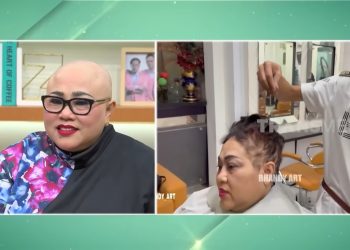 Cerita Haru Komedian Nunung Berkepala Plontos dan Sakit yang Dideritanya