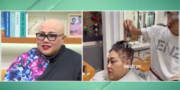 Cerita Haru Komedian Nunung Berkepala Plontos dan Sakit yang Dideritanya