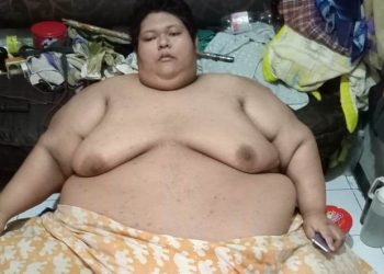 BPBD Kota Tangerang Sampai Harus Pakai Forklift untuk Evakuasi Pria Obesitas 300 Kg
