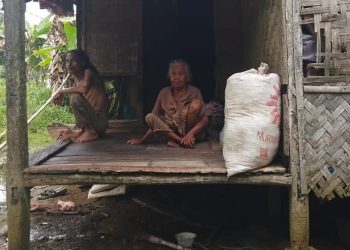 Miris, Pengidap TBC Akut Asal Lebak Ini Terabaikan