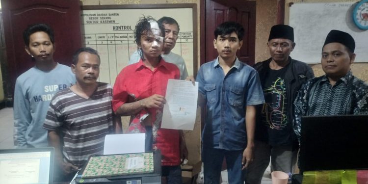 Kepergok Curi Ayam, Maling di Kasemen Kota Serang Babak Belur