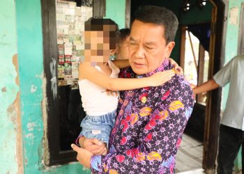 Bupati Tangerang Berikan Bantuan Pengobatan Bocah Penderita Kanker Mata di Kronjo