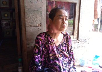 Tak Mampu Berobat, Janda di Pandeglang Pasrah Divonis Derita Tumor Ganas
