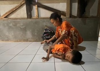 Miris Bocah 10 Tahun Asal Lebak Derita Lumpuh Layu