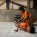 Miris Bocah 10 Tahun Asal Lebak Derita Lumpuh Layu