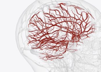 Dengan Alat Ini, Dokter Bisa Lihat Penyumbatan Pembuluh Darah Otak Secara Jelas