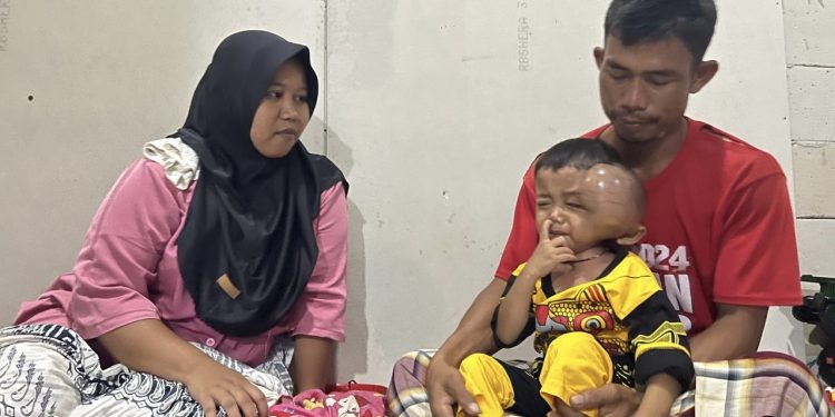 Menderita Tumor Ganas, Farhan Butuh Bantuan