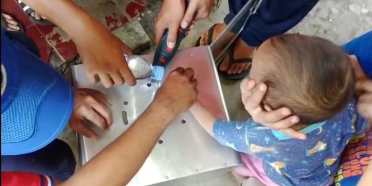 Jari Balita Terjepit Oven Kue, Kok Bisa?