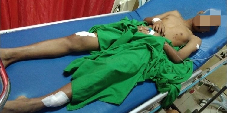 Dikeroyok Tanpa Sebab, Remaja Asal Pontang Alami Luka Parah
